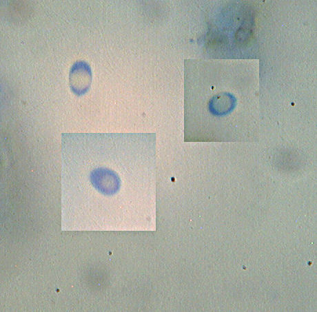 Hyphoderma sambuci
